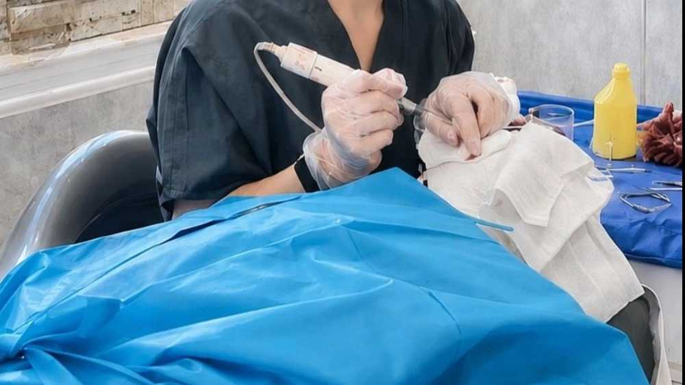 مرکز کاشت رشت رویان، خدمات تخصصی کاشت مو و ابرو به روش میکروگرافت