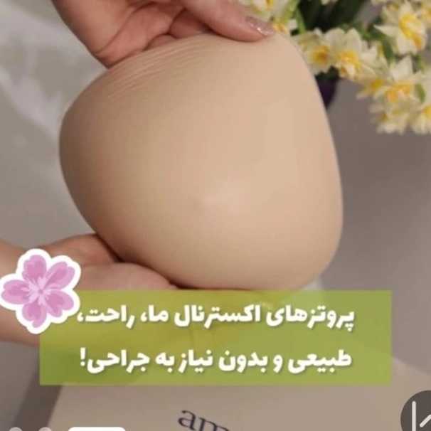1777653335742.webp