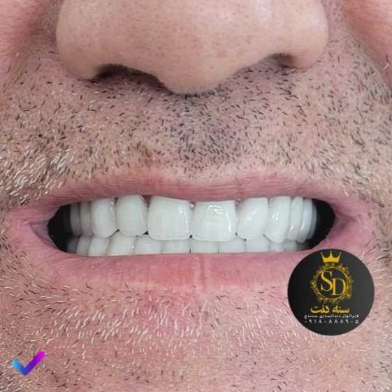 1710546282974.webp