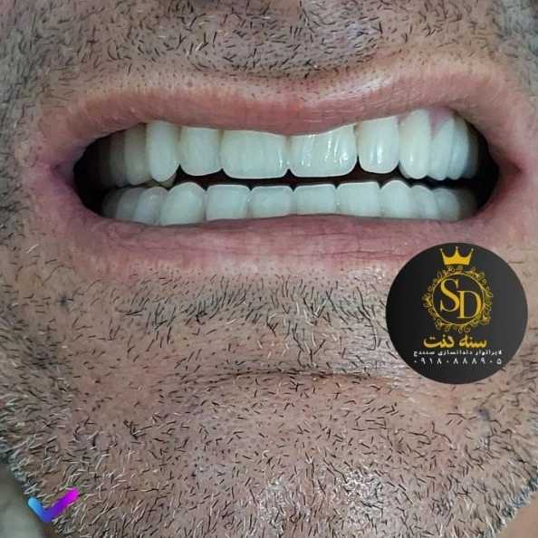 1710546582047.webp