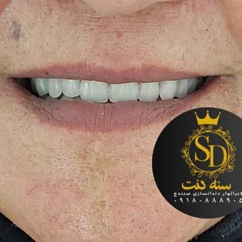 1710547621500.webp