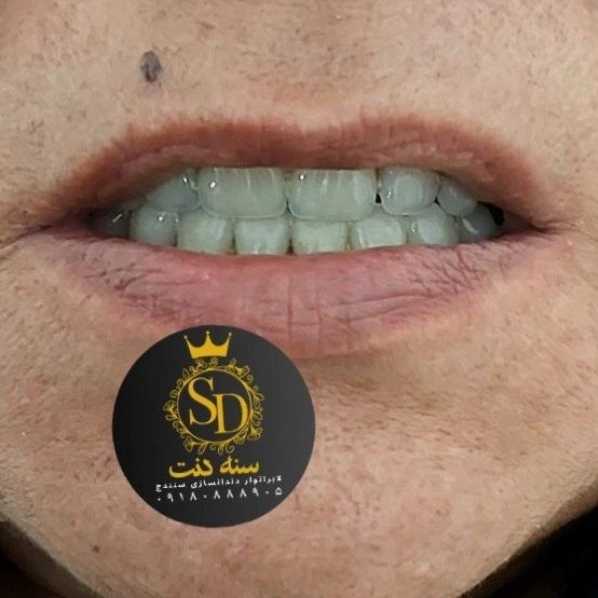 1710547917405.webp