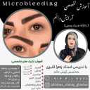 آکادمی زهرا قنبری، میکروبلیدینگ و فیبروز در تبریز