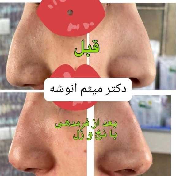 1714559499650.webp