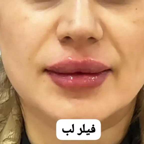 1714632440296.webp