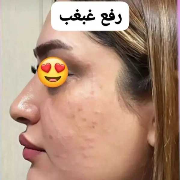 1714632455160.webp