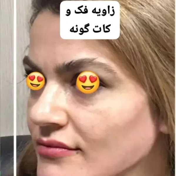 1714632469866.webp
