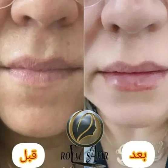 1715071878195.webp