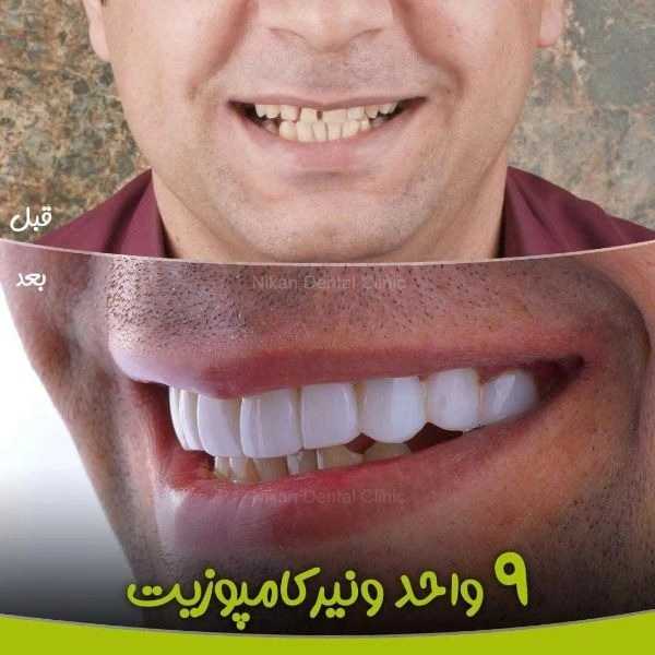 1717047427637.webp