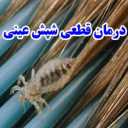 درمان قطعی شپش عینی در تهران