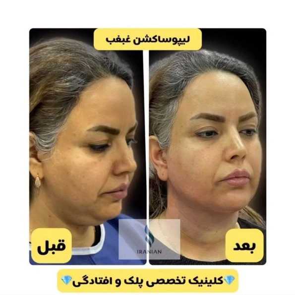 1722336602325.webp