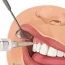 تجهیزات دندانپزشکی حیان، پخش سرسوزن تزریق کارتریج و گوتای متا در قم