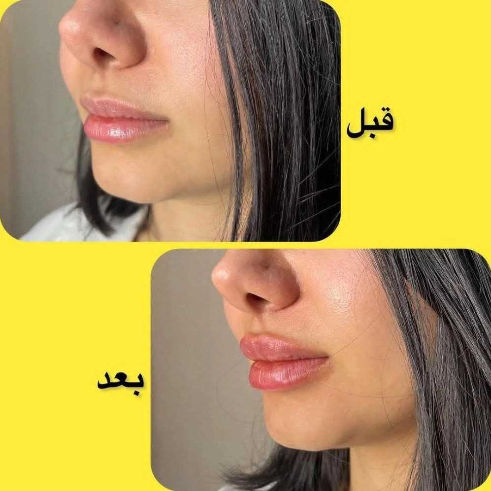 1740637385681.webp