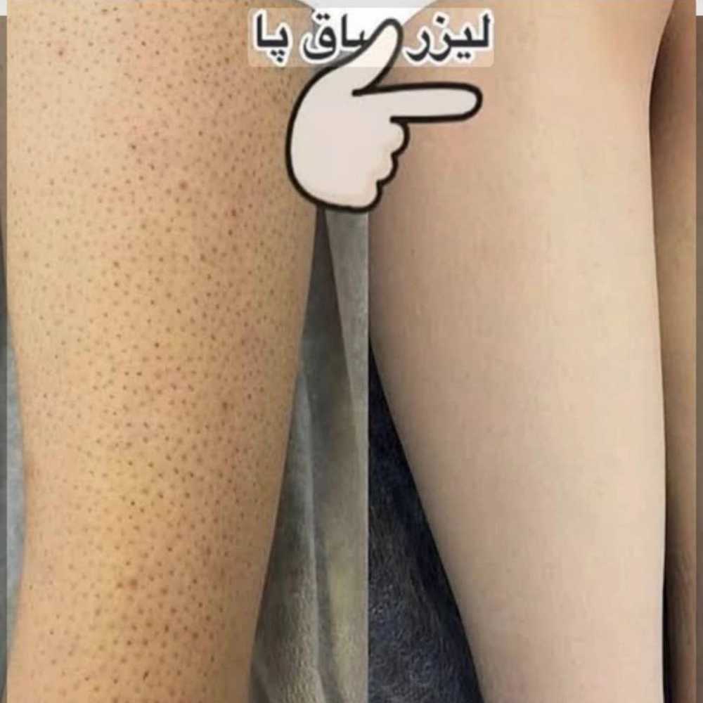 1755409053831.webp
