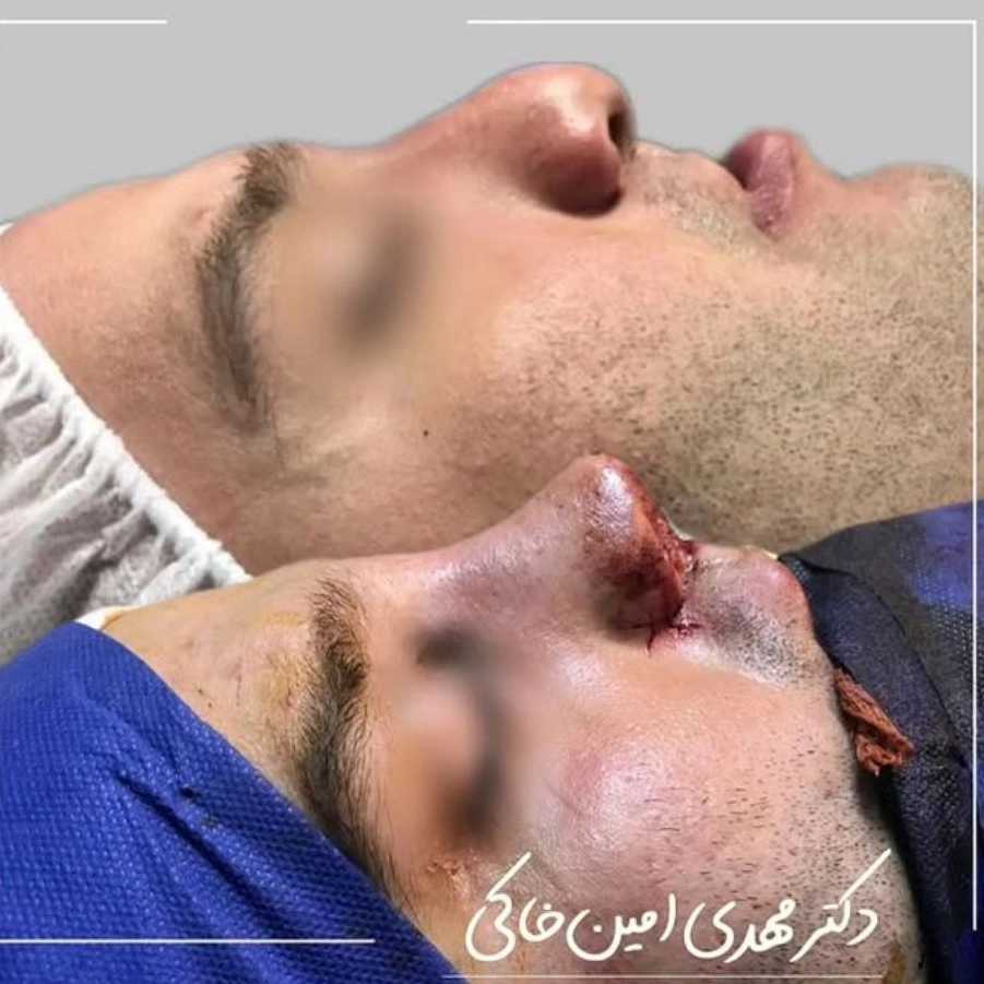 1763194383062.webp