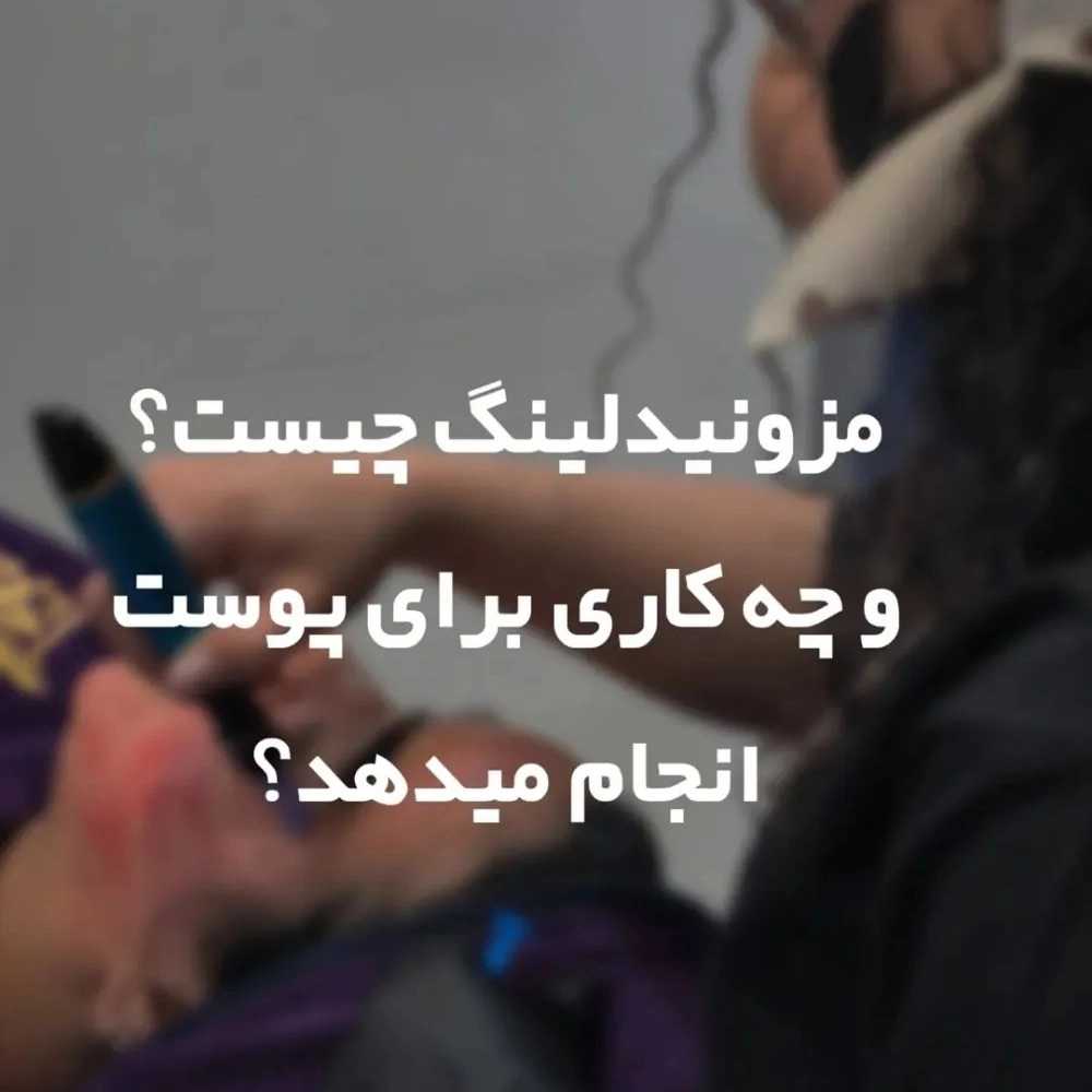 1763376687532.webp