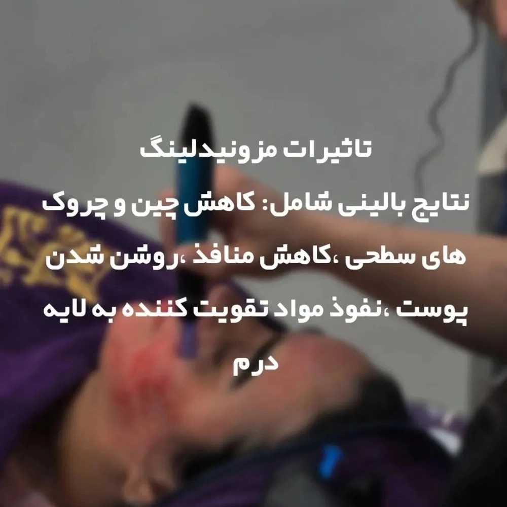 1763376776200.webp