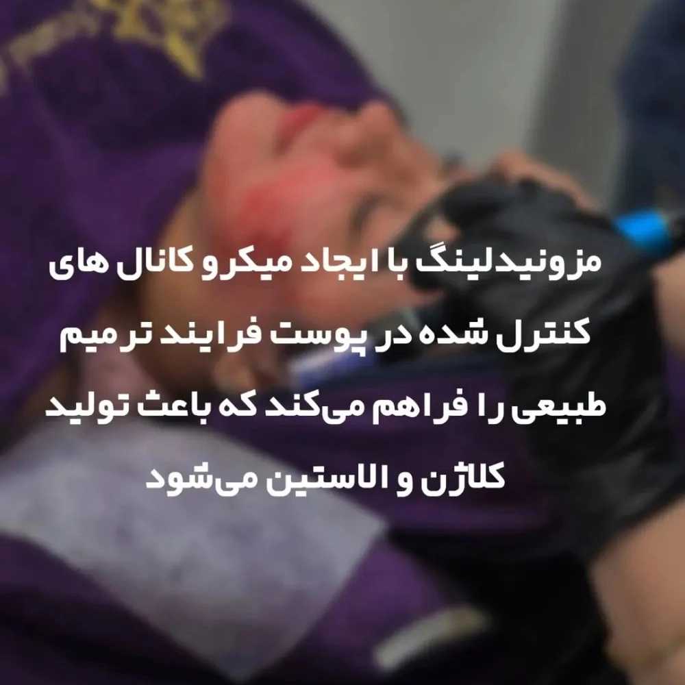 1763376796747.webp
