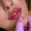 کلینیک زیبایی مای نا، ارائه خدمات ژل بوتاکس فیلر مزوتراپی و پی آرپی در کرمانشاه