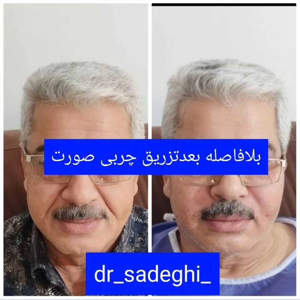 1776755146734.webp