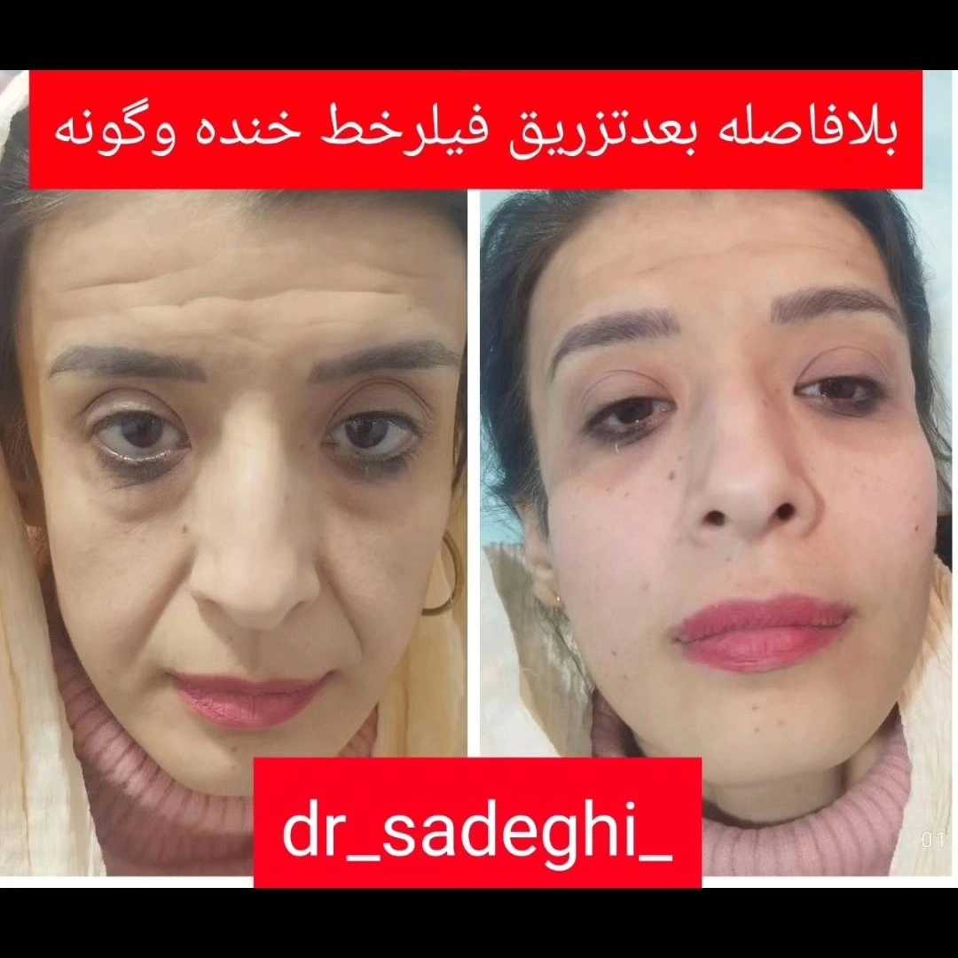1776755154395.webp