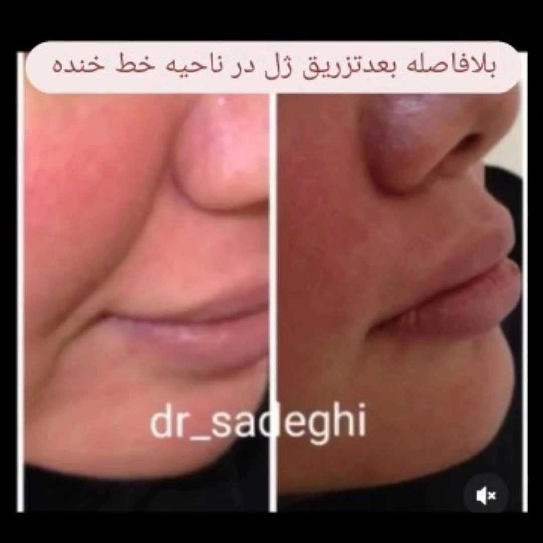 1776755666483.webp