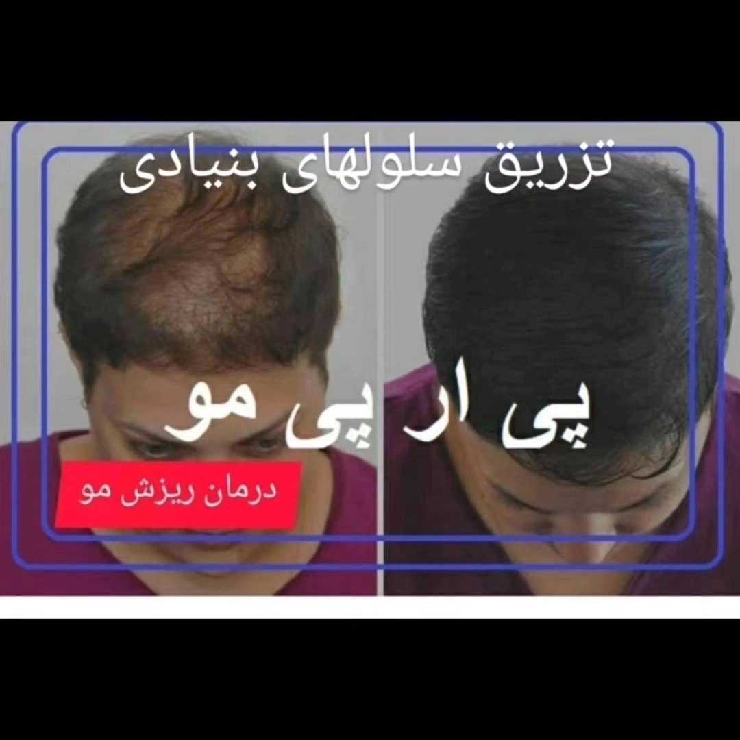 1776755689914.webp