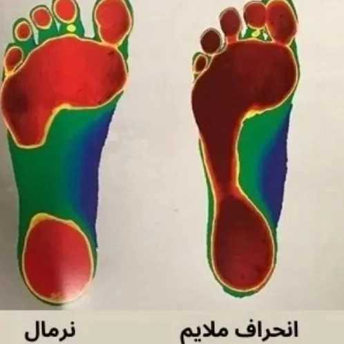 1777198726670.webp