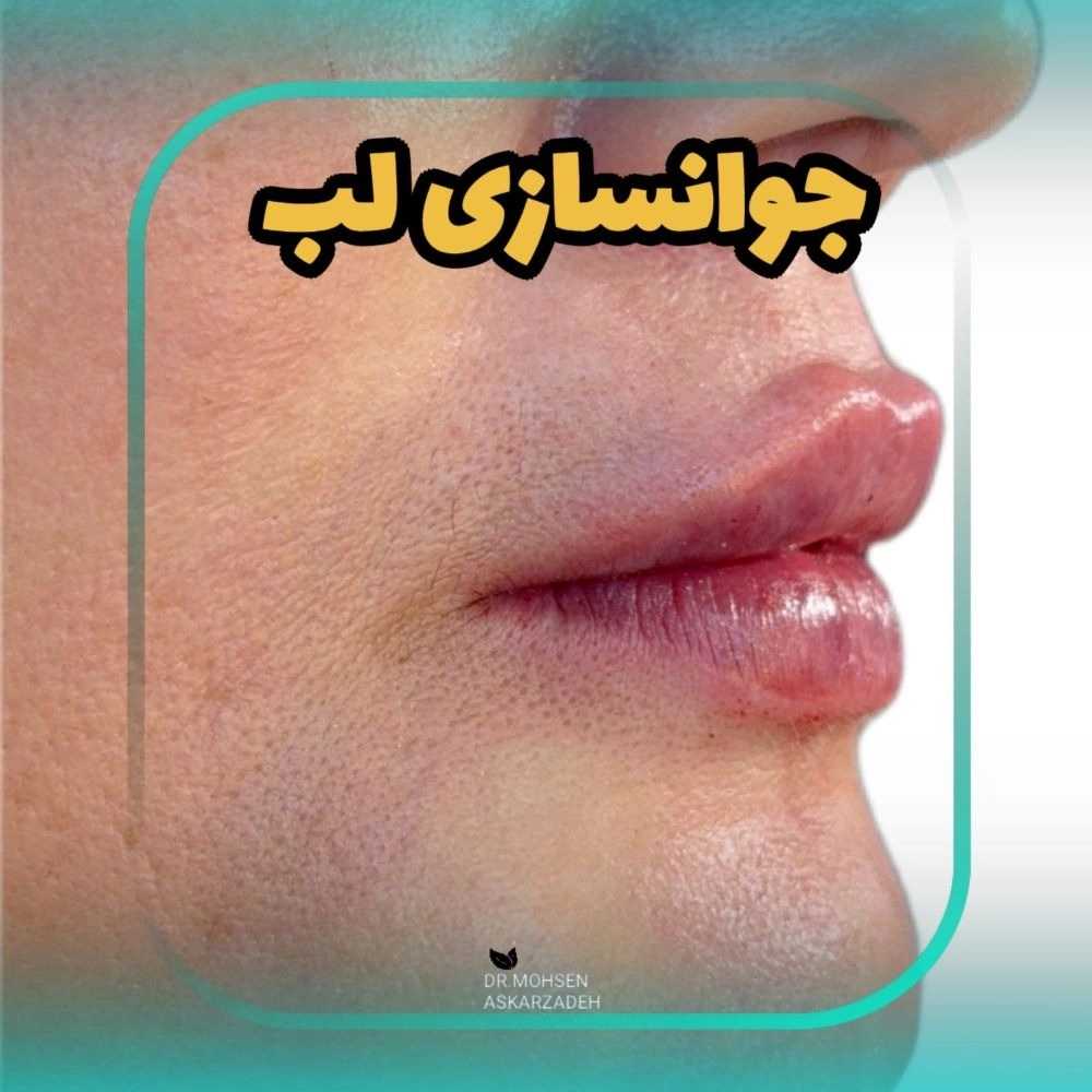 1777897094192.webp