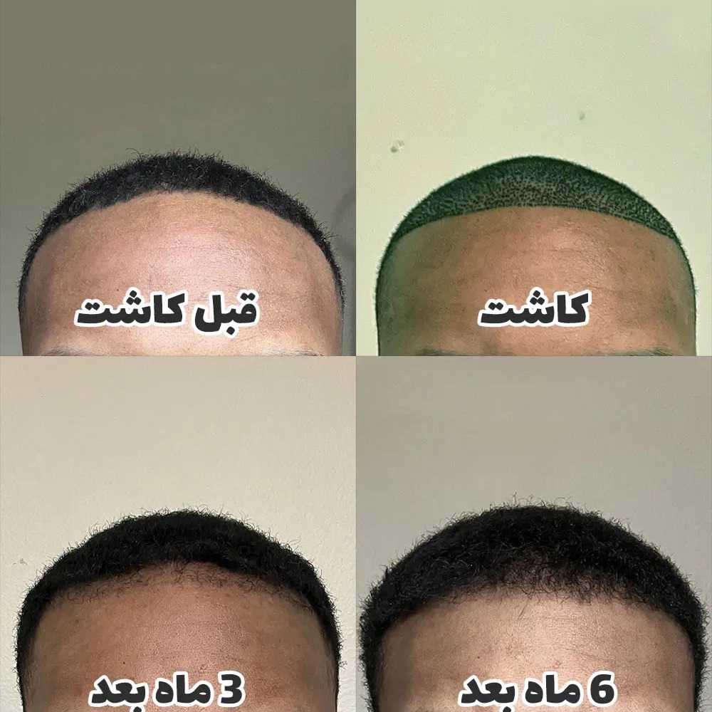 1778313595280.webp