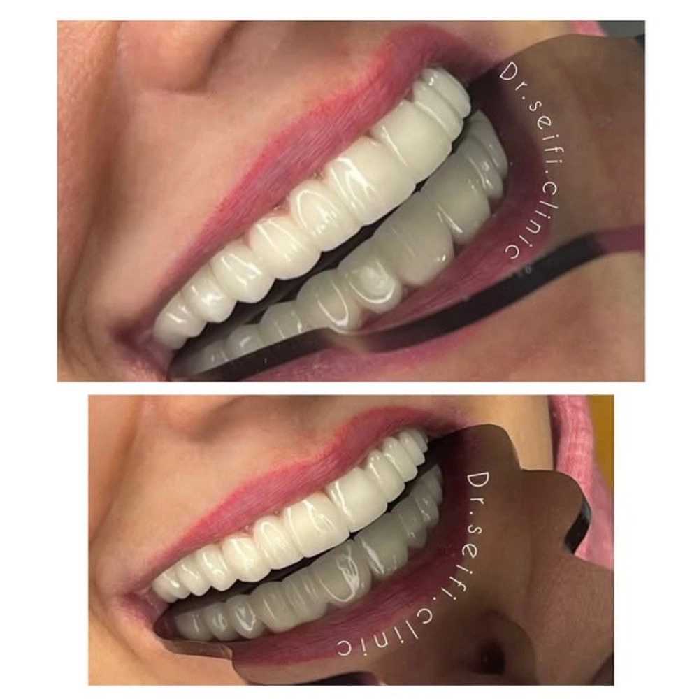 1780836160922.webp