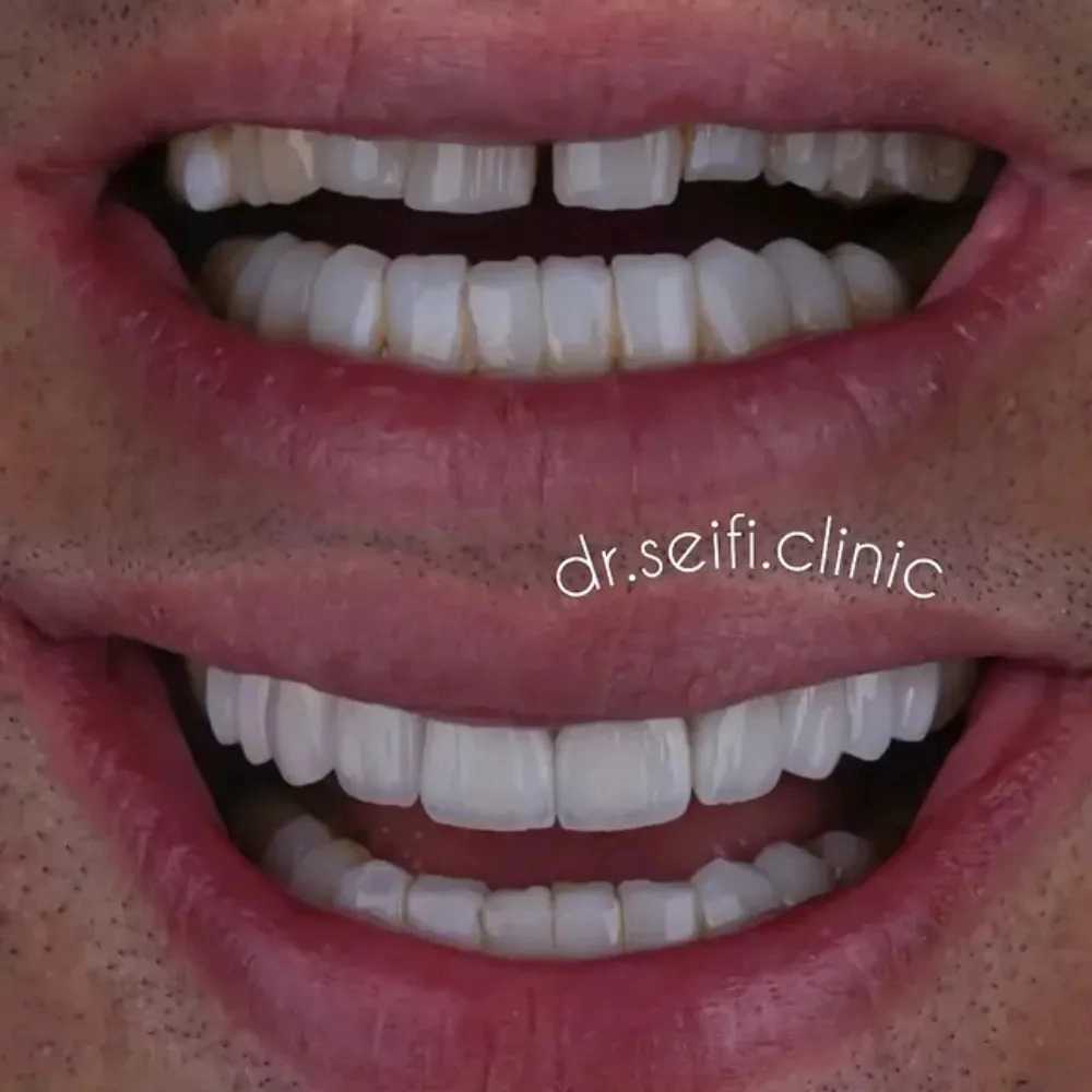 1780836179857.webp