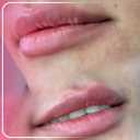 کلینیک زیبایی موانا، خدمات زیبایی و فیلر لب بوتاکس و جوانسازی در سبزوار
