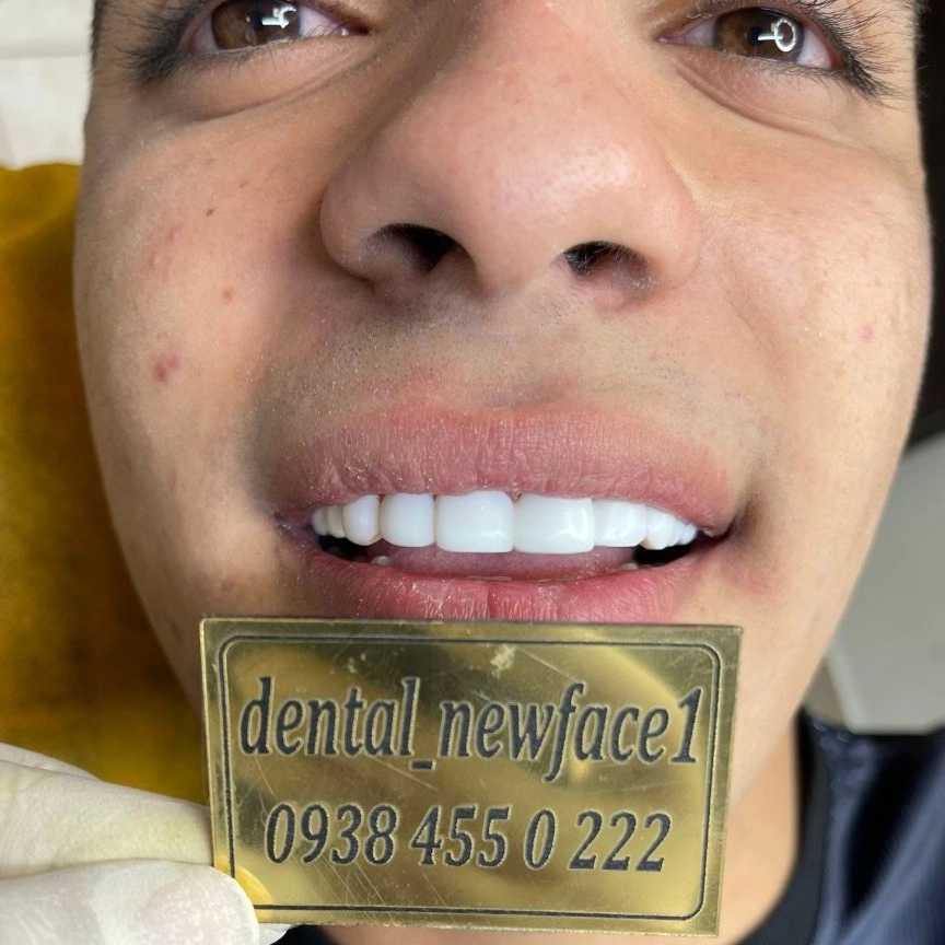 1692164966980.webp