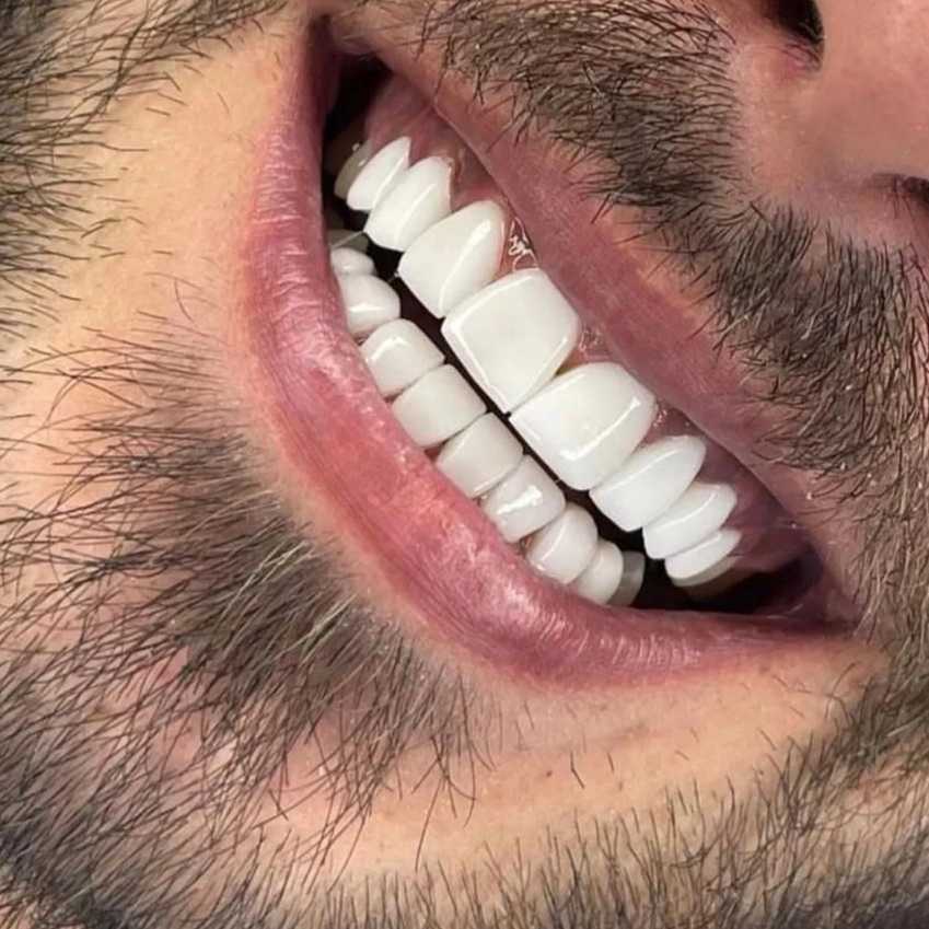1693458364029.webp