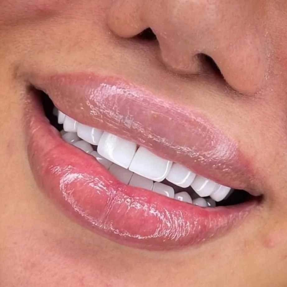 1693458405986.webp