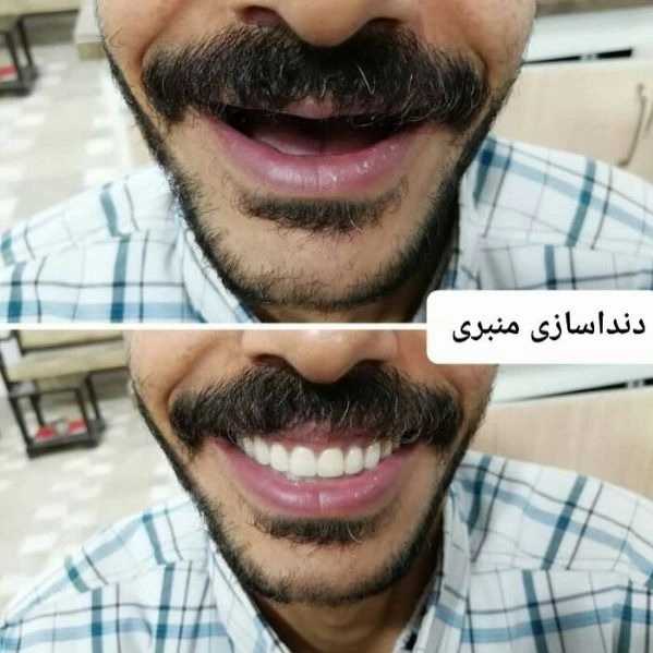1698652558619.webp