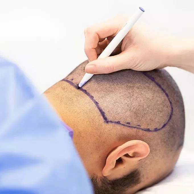 کلینیک تخصصی کاشت مو و لیزر سارای دکتر رحیمی