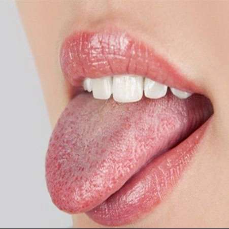 تشخیص بیماری از زبان  کاظمی رشت