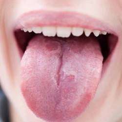 تشخیص بیماری از زبان  کاظمی رشت
