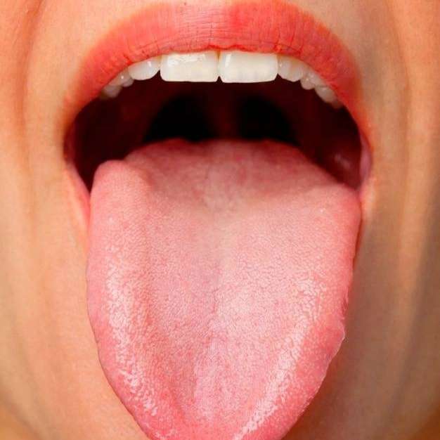 تشخیص بیماری از زبان  کاظمی رشت
