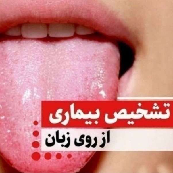 تشخیص بیماری از زبان  کاظمی رشت