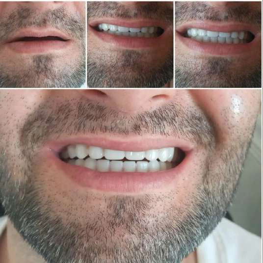 دندان مصنوعی و لابراتوار دندانسازی آرش منبری در سنندج