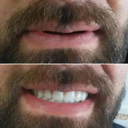 دندان مصنوعی و لابراتوار دندانسازی آرش منبری در سنندج