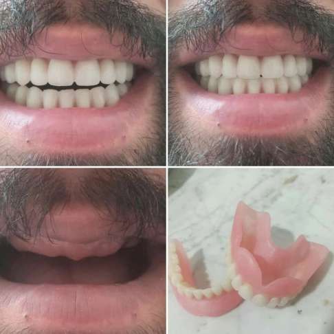 دندان مصنوعی و لابراتوار دندانسازی آرش منبری در سنندج