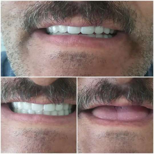 دندان مصنوعی و لابراتوار دندانسازی آرش منبری در سنندج
