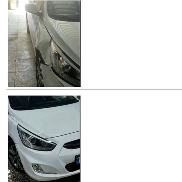 قبل و بعد