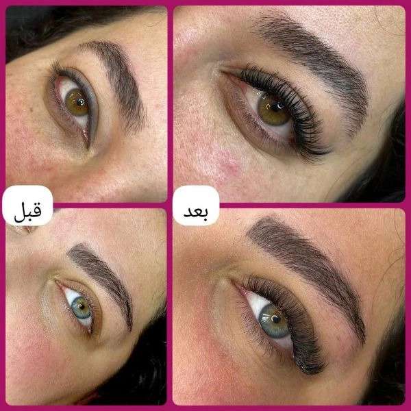 کاشت مژه