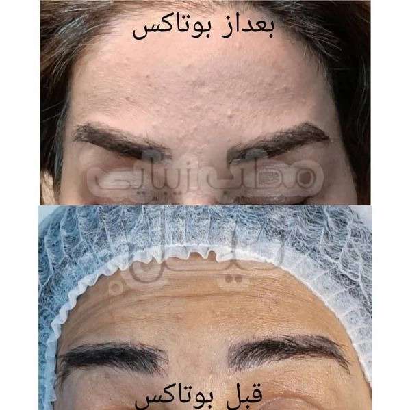 مطب زیبایی نیل