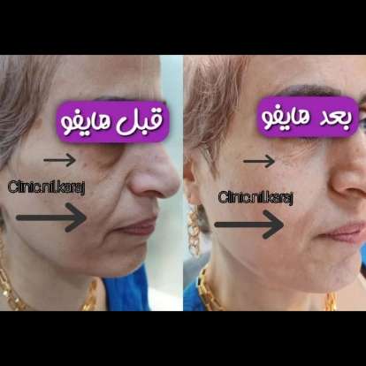 مطب زیبایی نیل